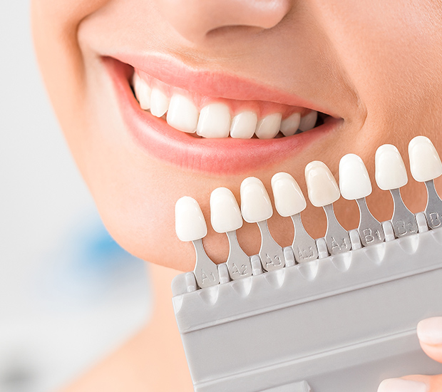 Laguna Hills Dental Veneers and Dental Laminates