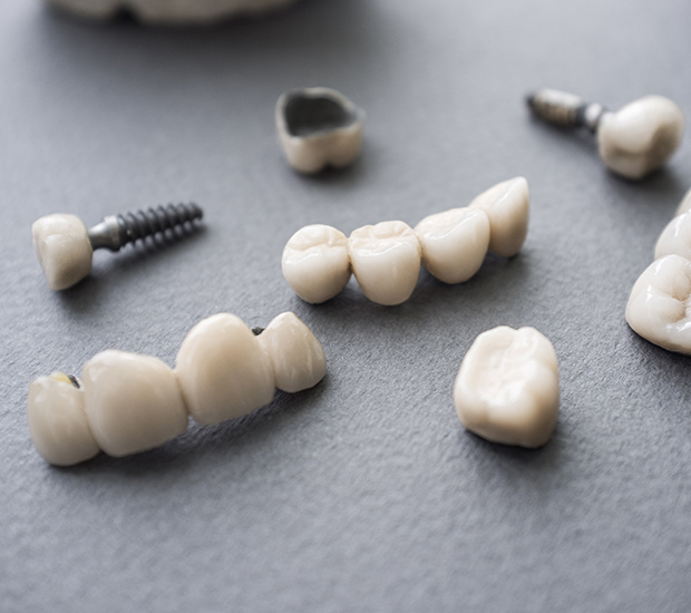 Laguna Hills The Difference Between Dental Implants and Mini Dental Implants