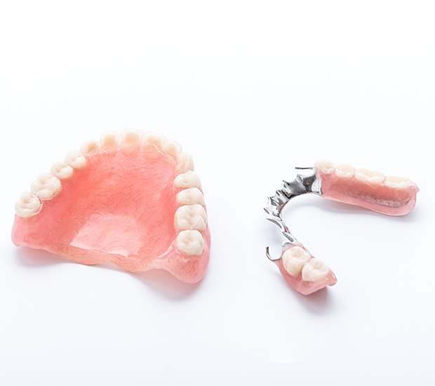 Laguna Hills Partial Dentures for Back Teeth